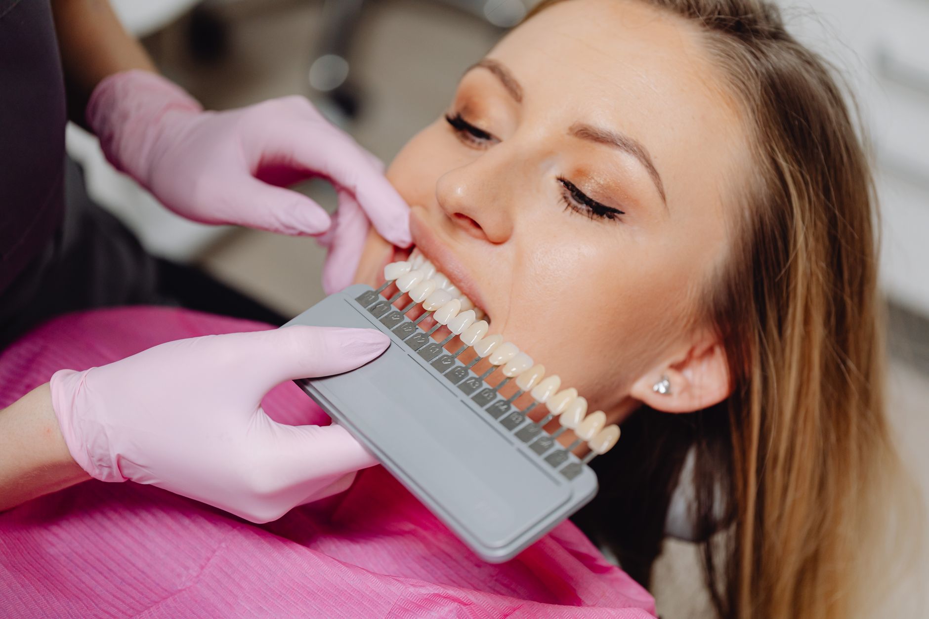 veneers vs crowns vashi navi mumbai dental shade guide tooth colour matching at clinic